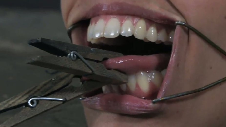 Mouth mouth bondage